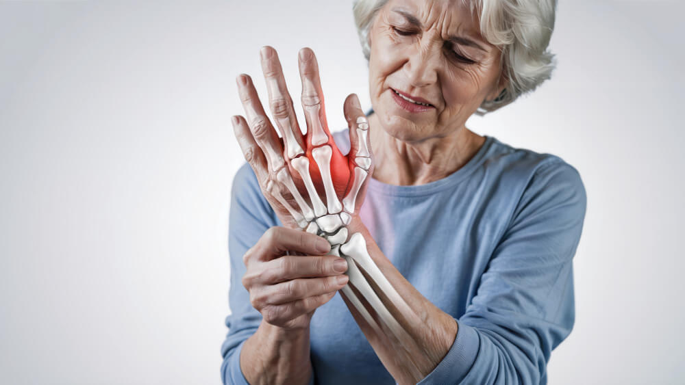 דלקת מפרקים שגרונית